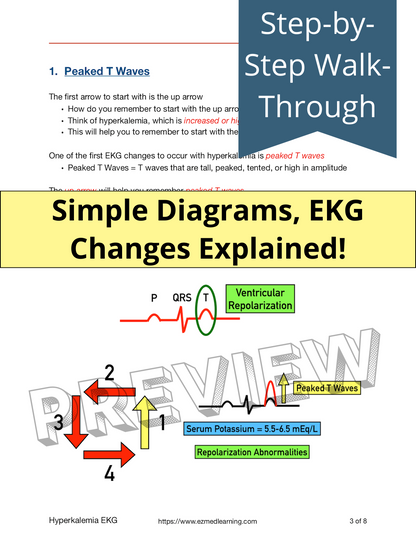 Hyperkalemia EKG Changes [Study Guides]