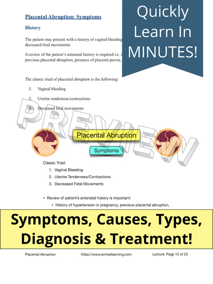 Placental Abruption [PDF Lecture]
