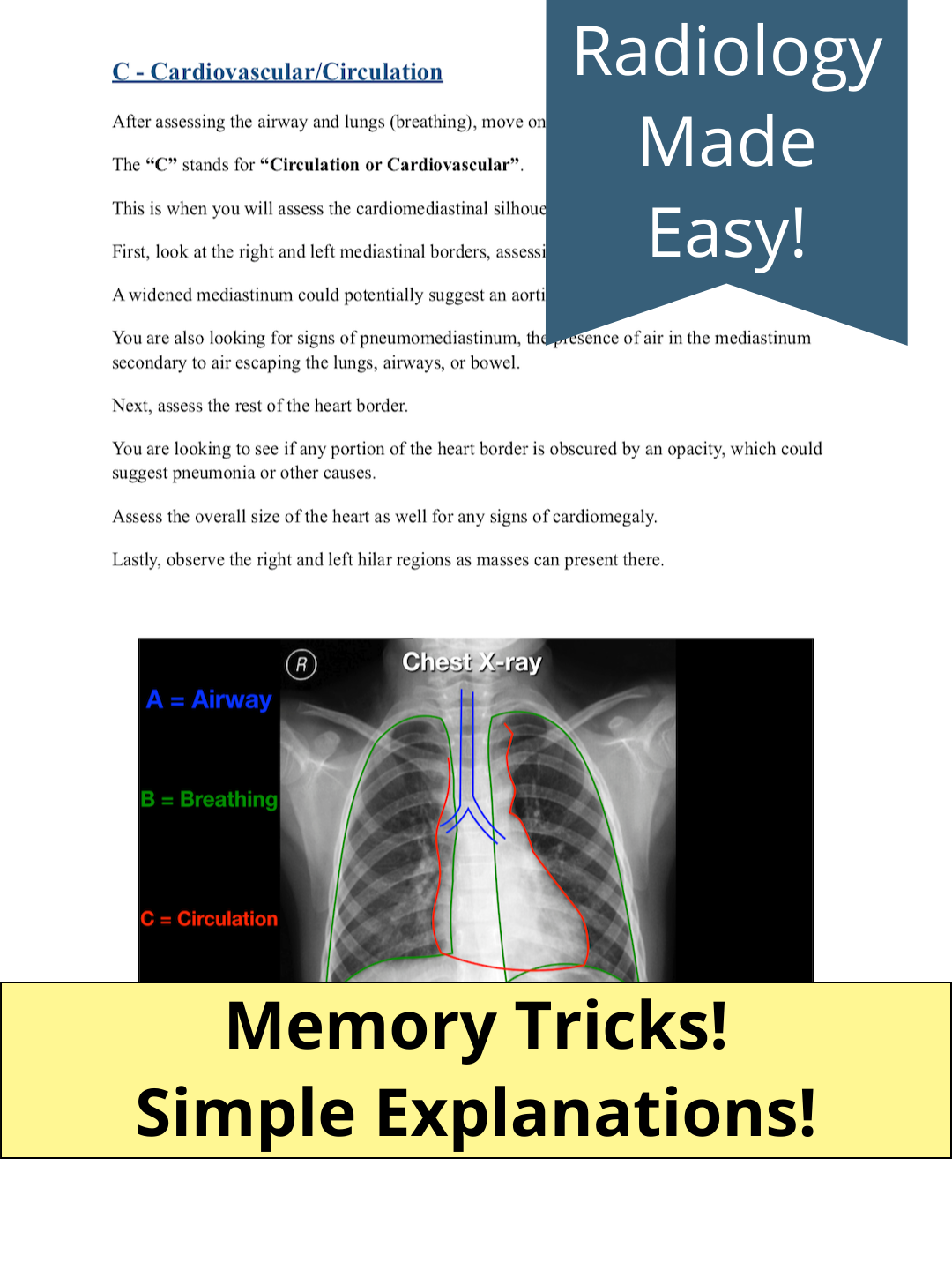 How To Read A Chest X-ray [PDF Lecture] – EZmed